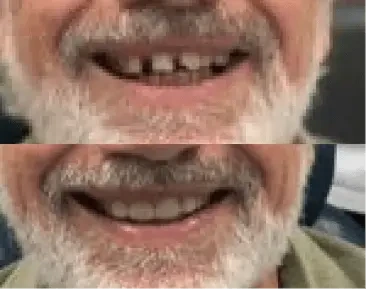before-after